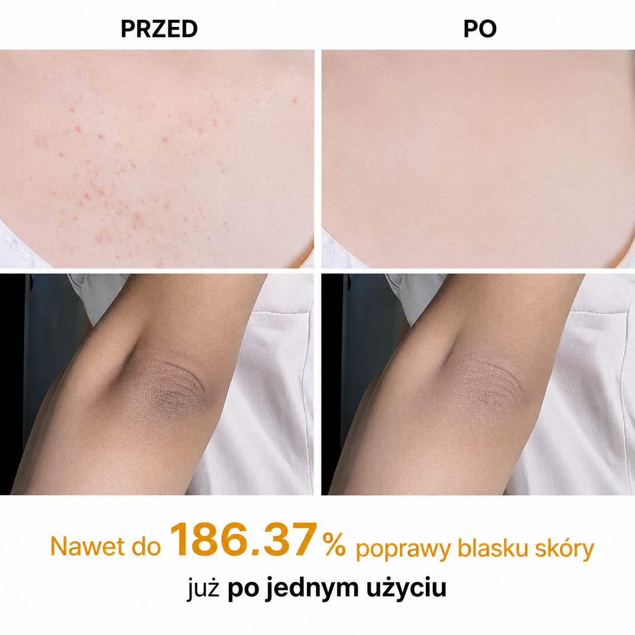 Turmeric Kojic Acid Essence Spray